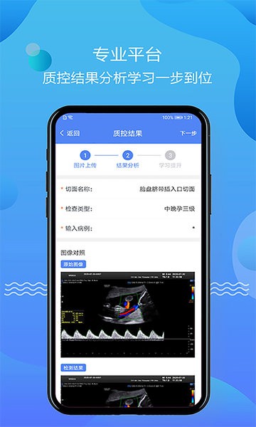 超声智库  v1.0图2